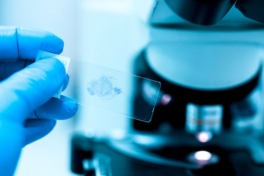 В раковых клетках обнаружены молекулярные «защитники»