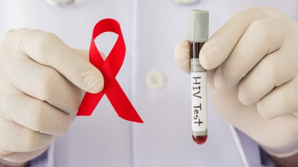 Министерство здравоохранения: В Азербайджане зарегистрировано более 11 тысяч больных СПИДом