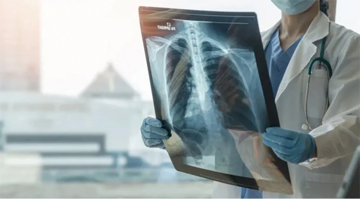 В прошлом году в Азербайджане было объявлено число детей, заразившихся туберкулезом