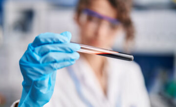 Устранено препятствие для ранней диагностики болезни Альцгеймера