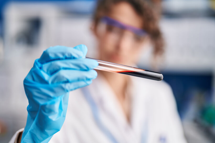 Устранено препятствие для ранней диагностики болезни Альцгеймера