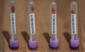 ABC: США отслеживают случаи хантавируса с кодом «экстренной помощи 3-го уровня»