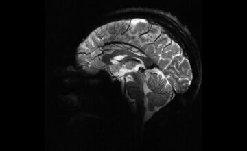 Ученые создали искусственные нервные клетки, способные взаимодействовать с мозгом