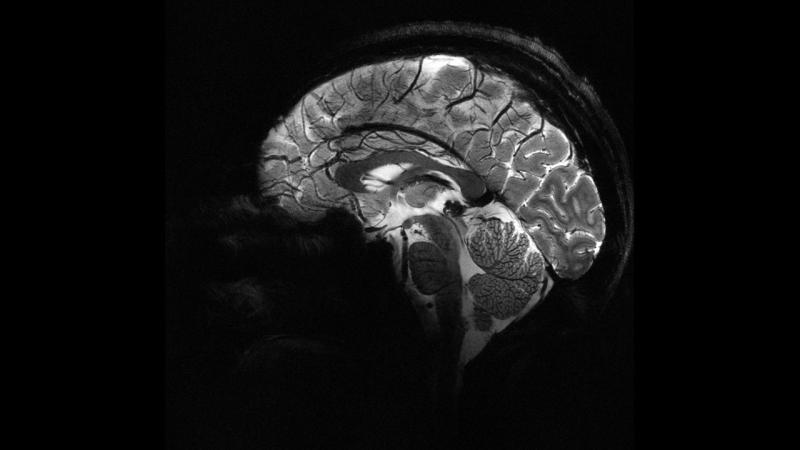 Ученые создали искусственные нервные клетки, способные взаимодействовать с мозгом