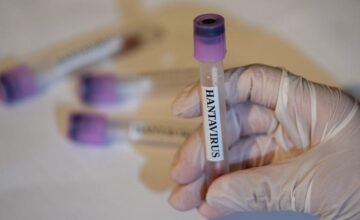 ВОЗ: Страны должны быть готовы к новым случаям хантавируса