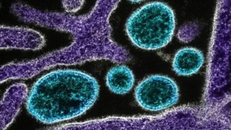 Мексика в тревоге: 6 искусственных озер закрыты после обнаружения «поедающей мозг амебы»